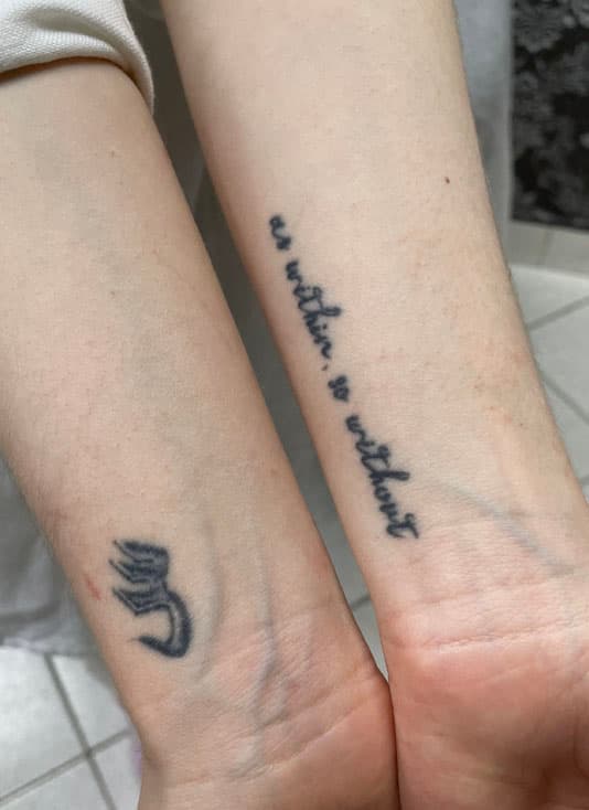 Napis pred laserskim odstranjevanjem