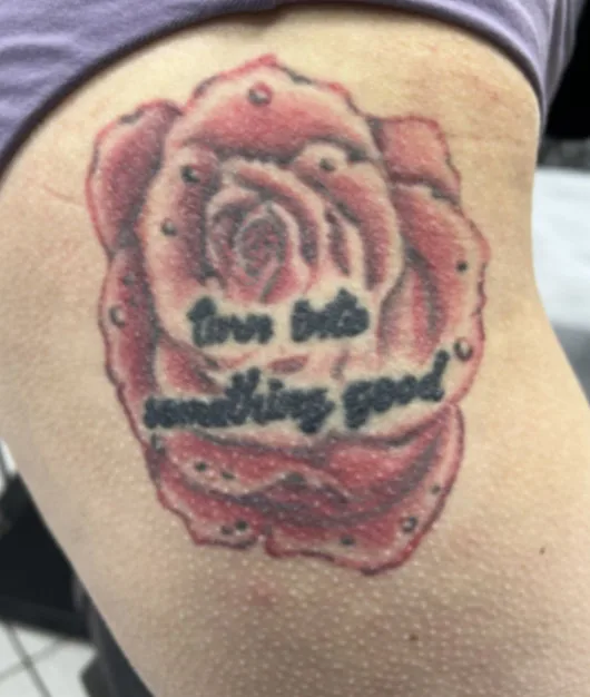 Barvni tattoo pred laserskim odstranjevanjem