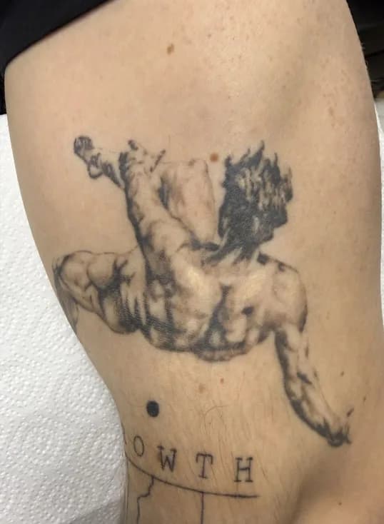 Temnejši tattoo po treh tretmajih laserskega odstranjevanja